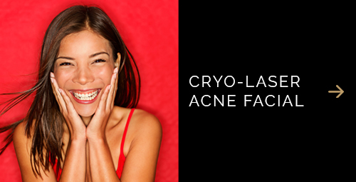 Acne Facial Cryo