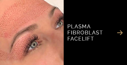 Adore Skin Studio Med Spa Plasma Fibro Blast Facelift